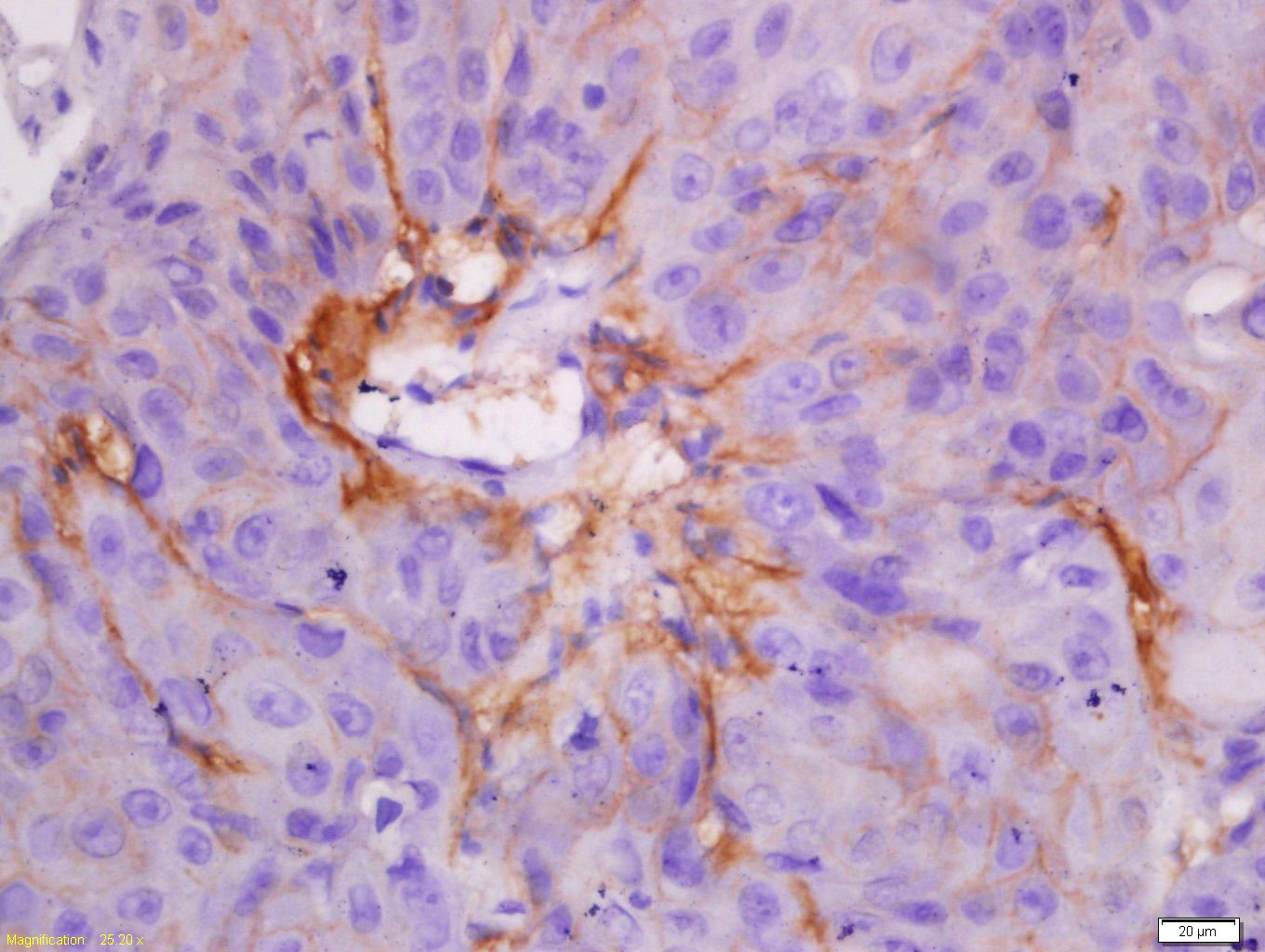 Anti-KRT7 Polyclonal Antibody