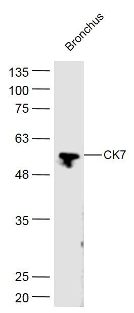 Anti-KRT7 Polyclonal Antibody