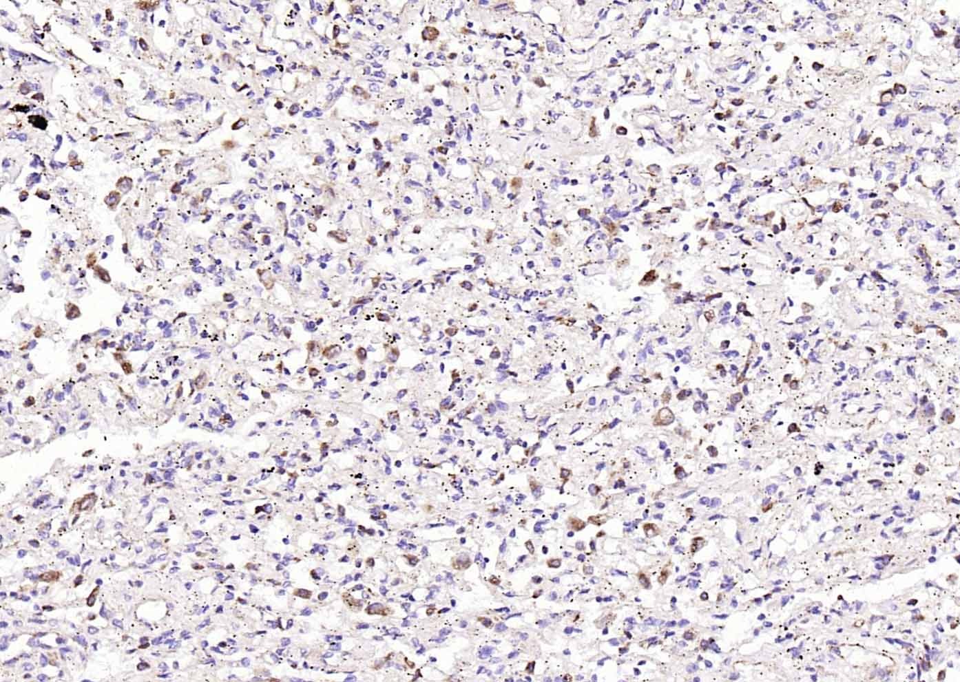 Anti-LAMP1 Polyclonal Antibody