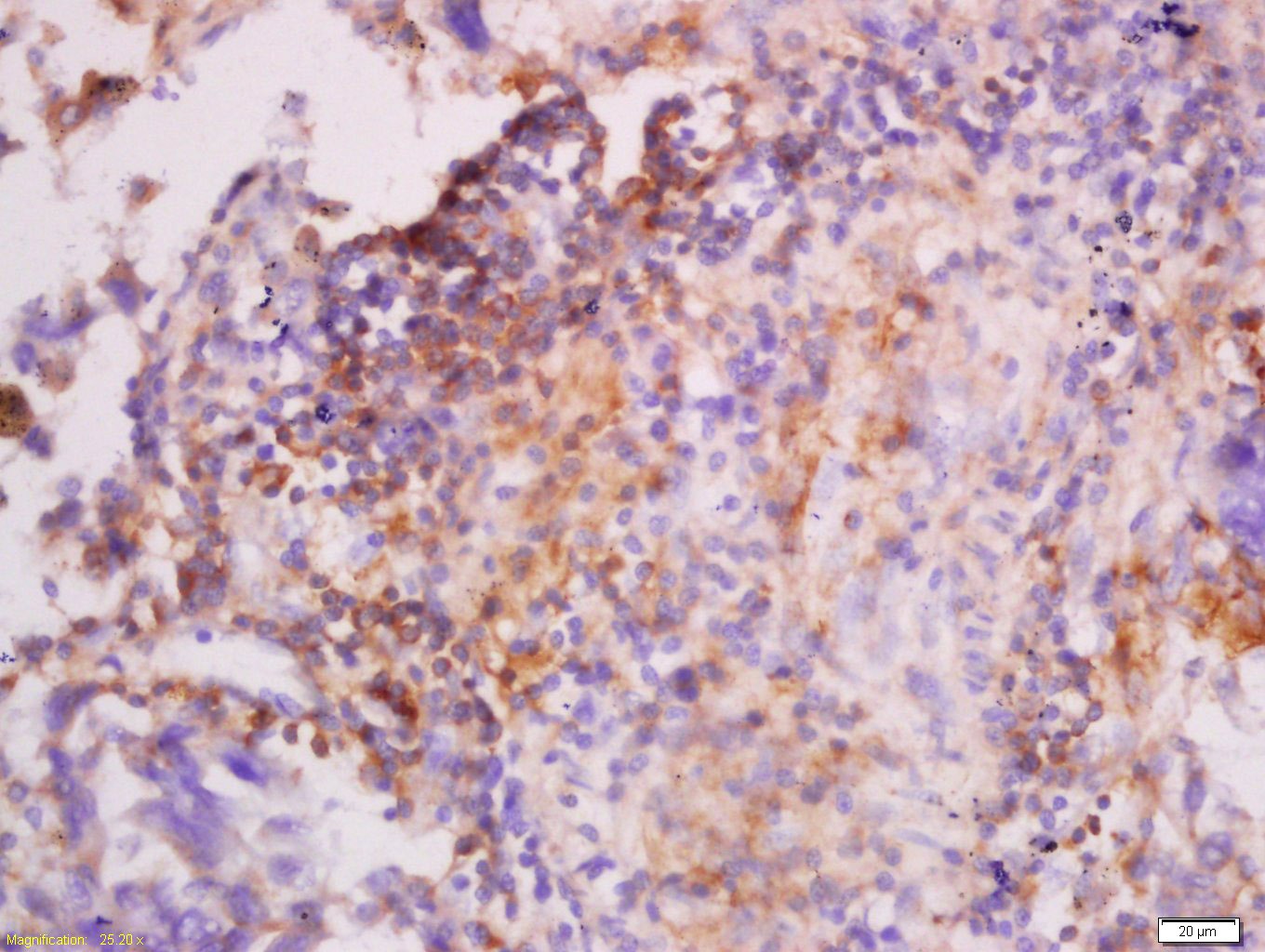 Anti-KRT7 Polyclonal Antibody