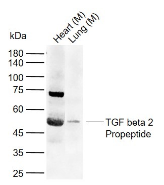 Anti-Latent TGF-beta 2 Polyclonal Antibody