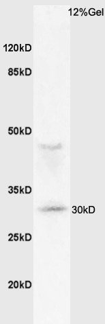Anti-MHC Class II Polyclonal Antibody 2