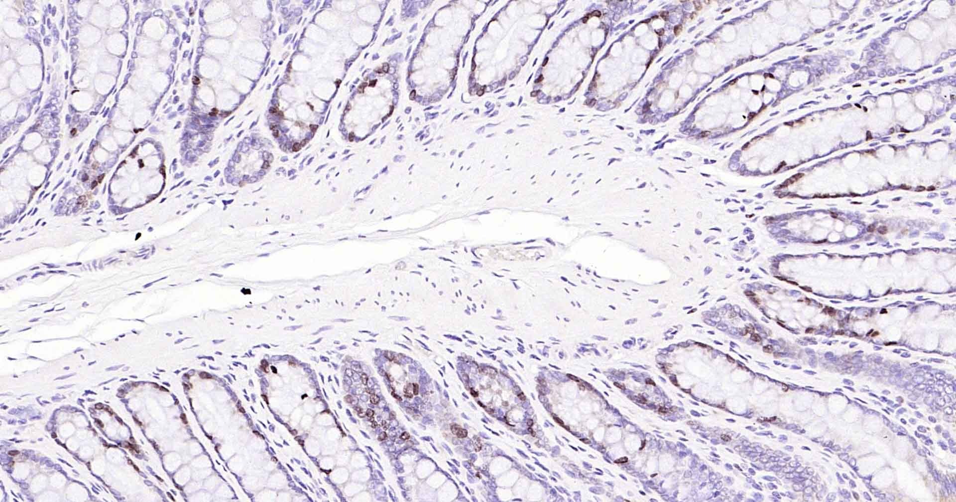 Anti-MKI67 Antibody (3A821)