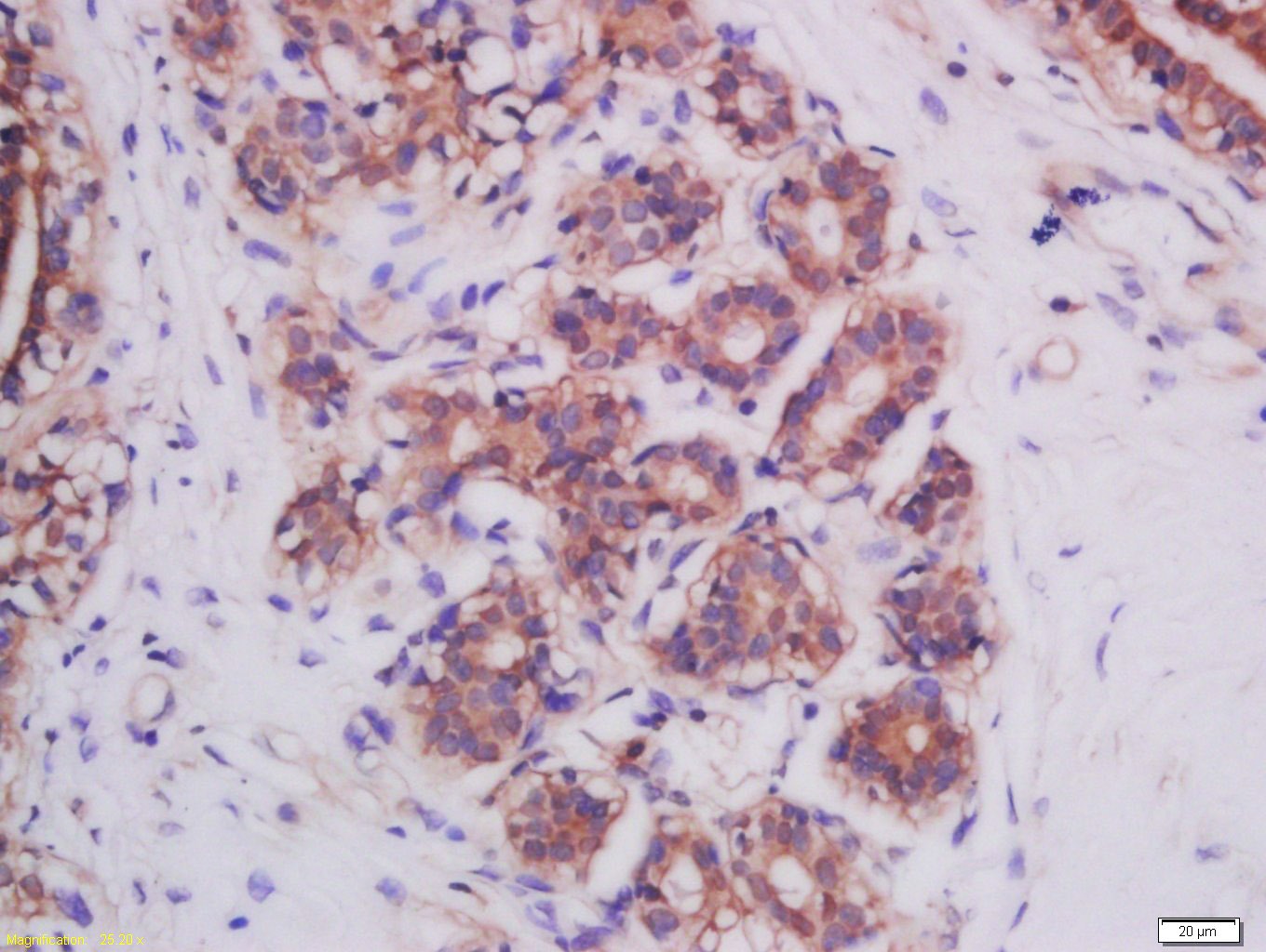 Anti-MFN2 Polyclonal Antibody
