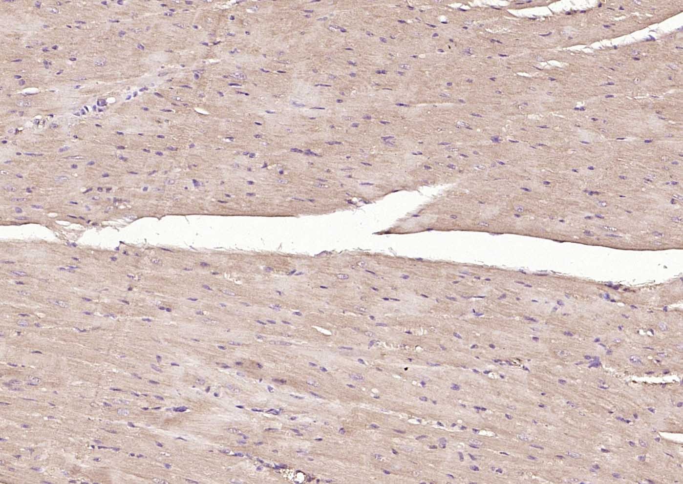 Anti-MFN1 Antibody (5U87)