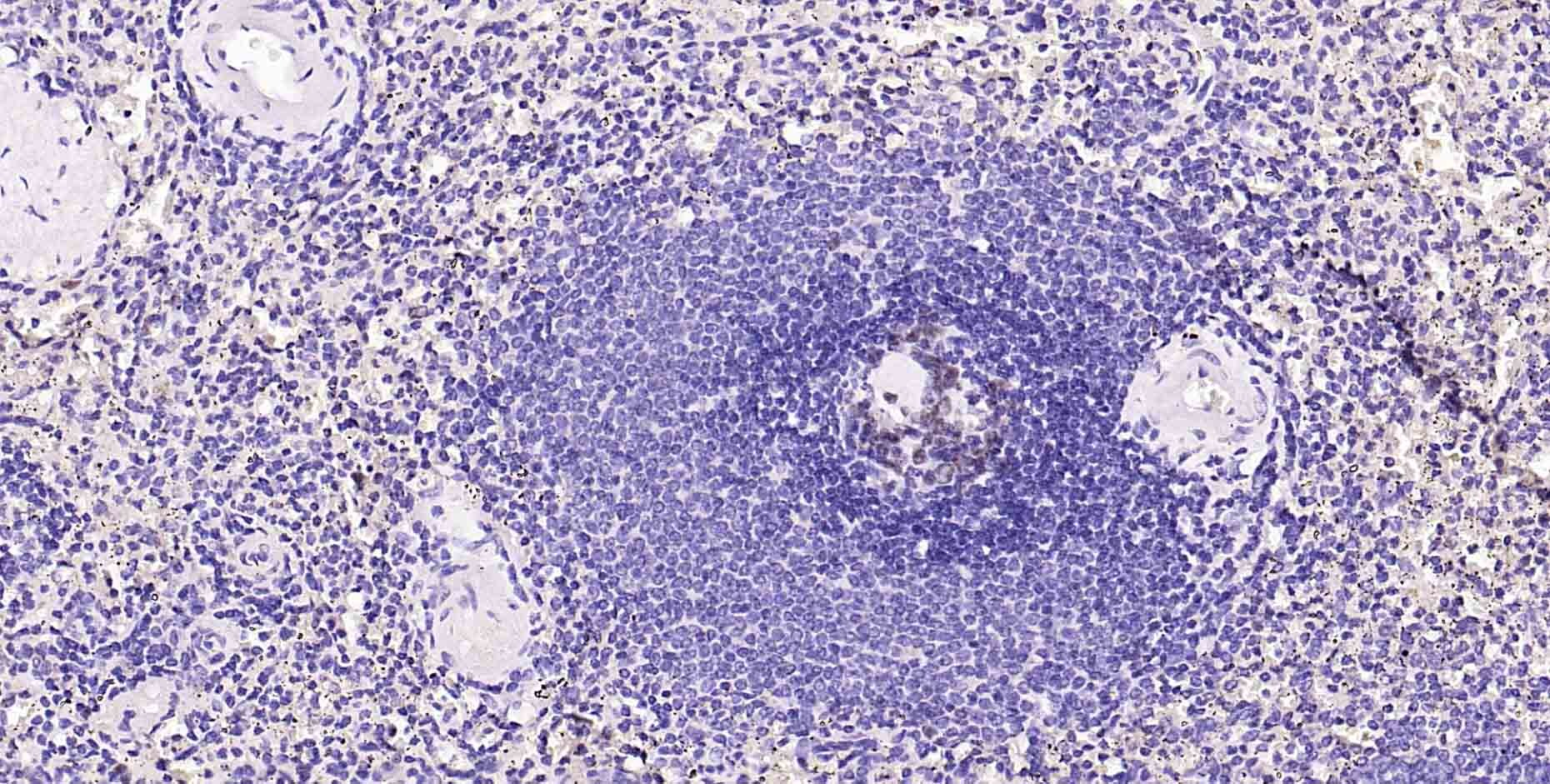 Anti-MKI67 Antibody (3A821)