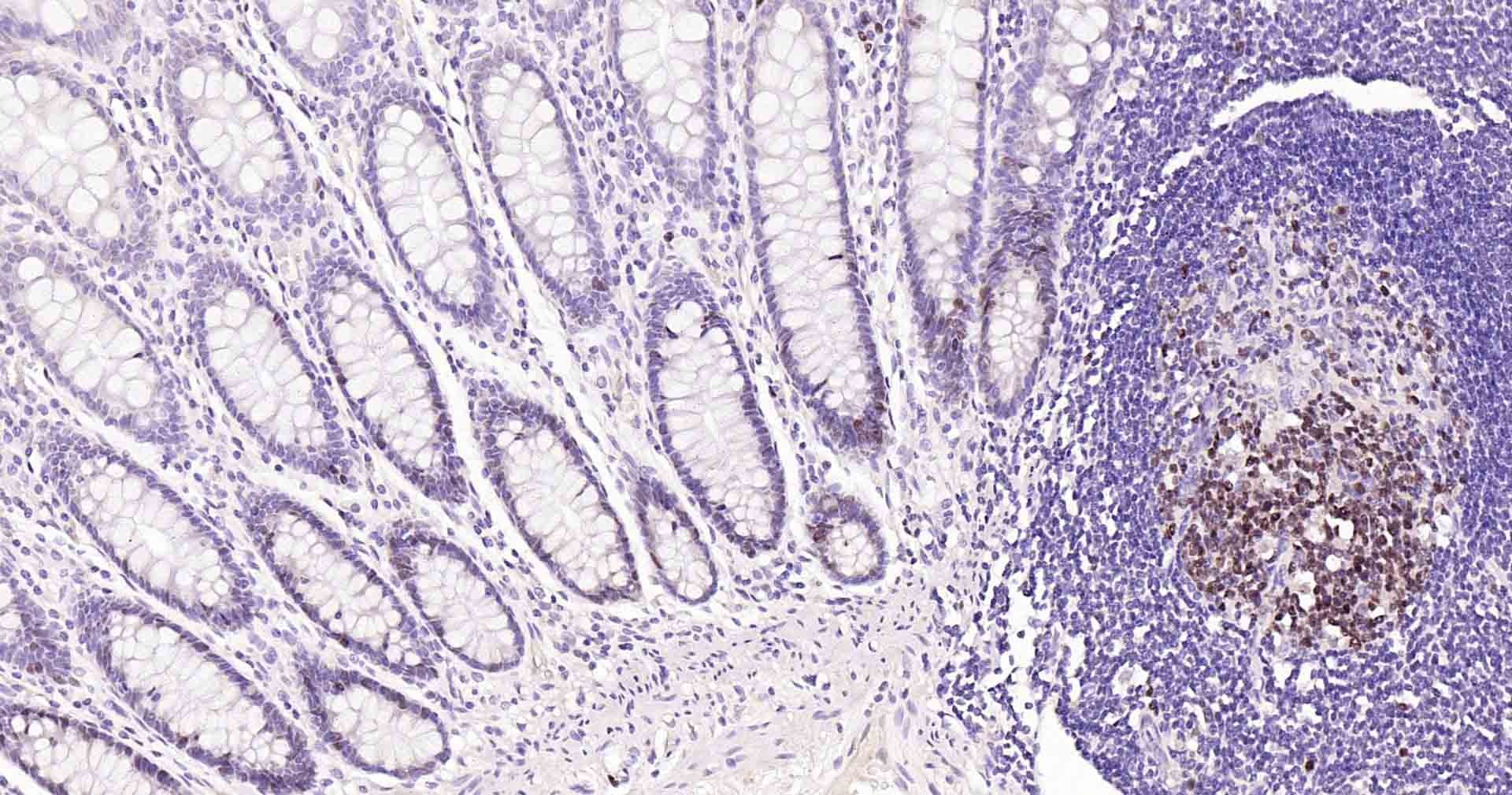 Anti-MKI67 Antibody (3A821)