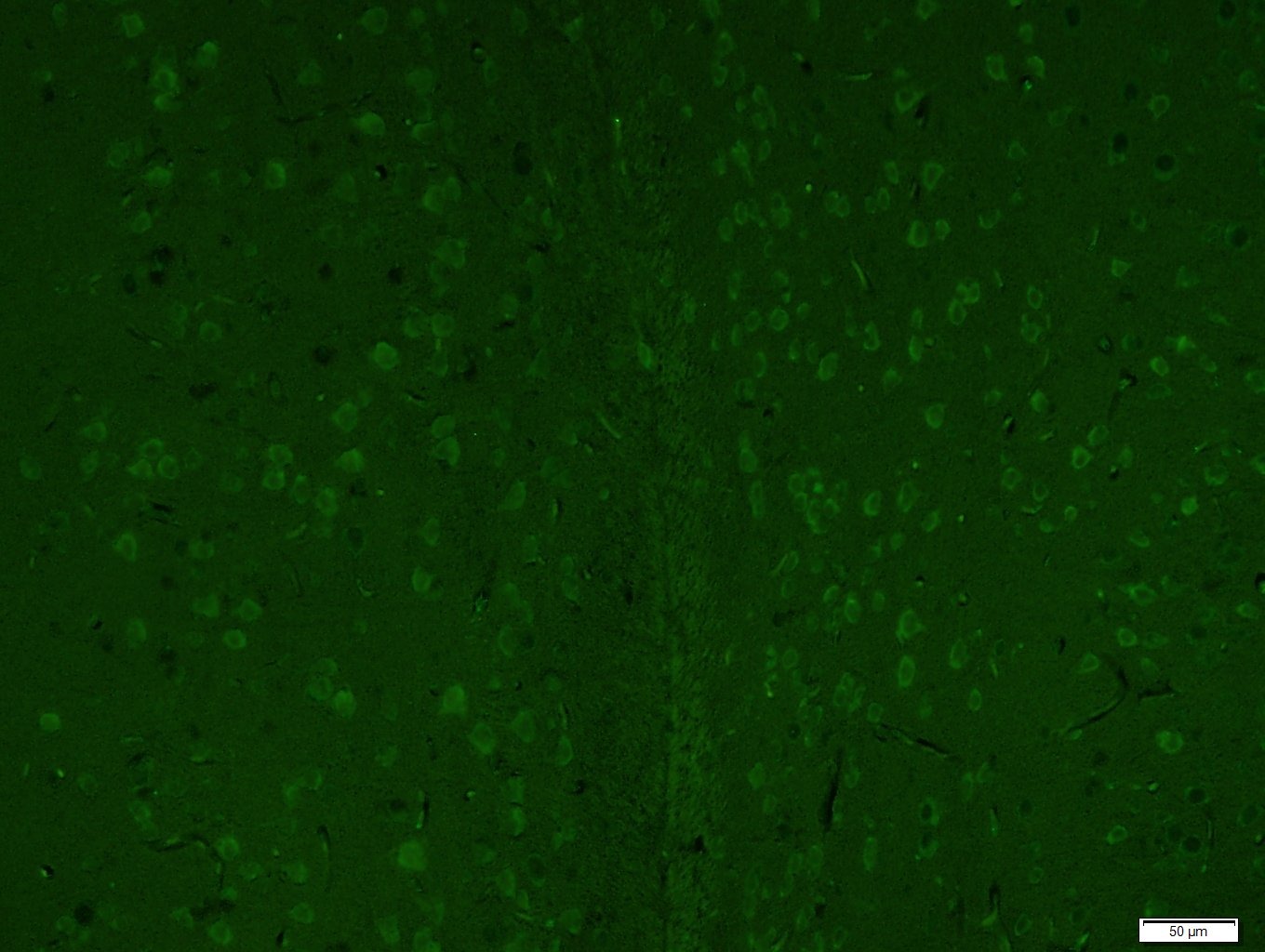 Anti-LC3A Antibody (4U976)