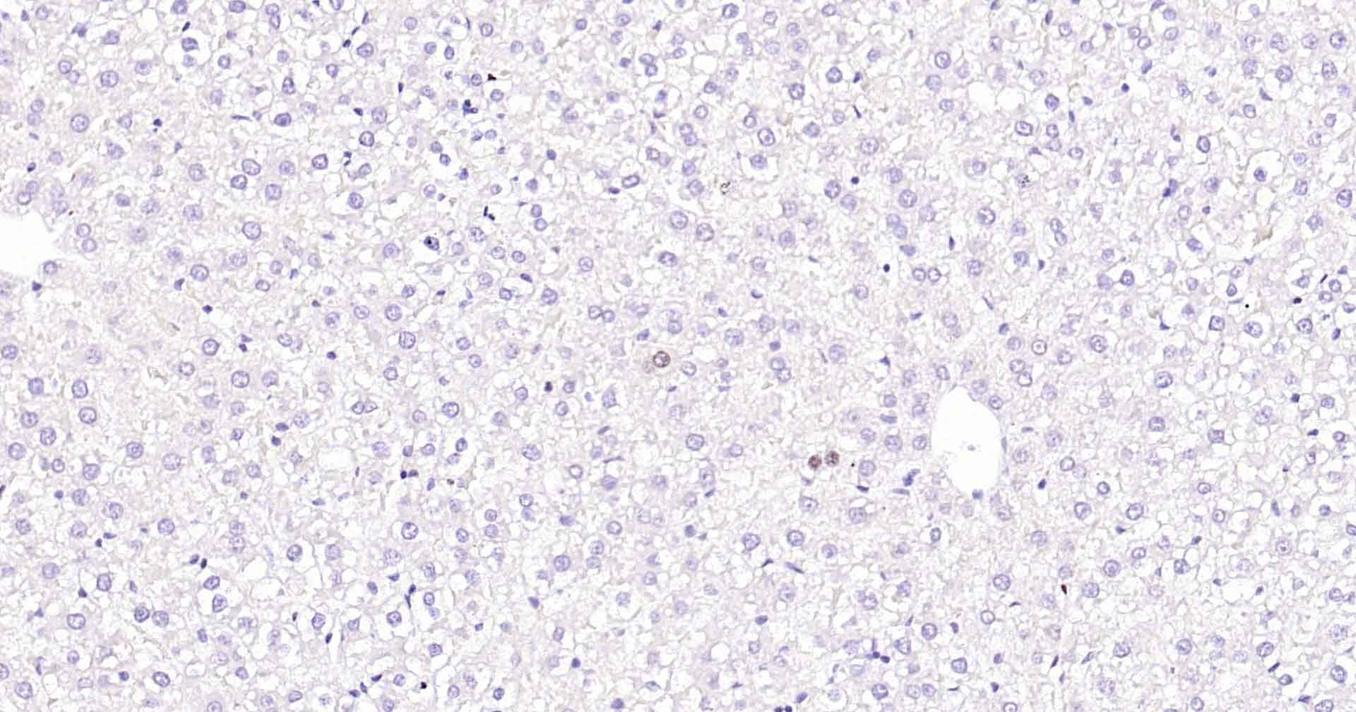 Anti-MKI67 Antibody (3A821)