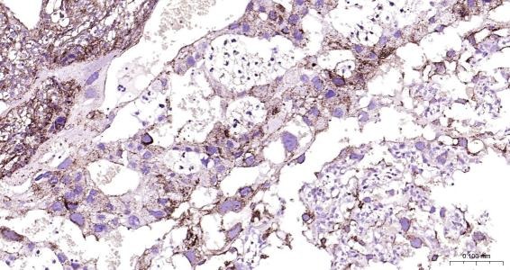 Anti-LAMP2 Polyclonal Antibody