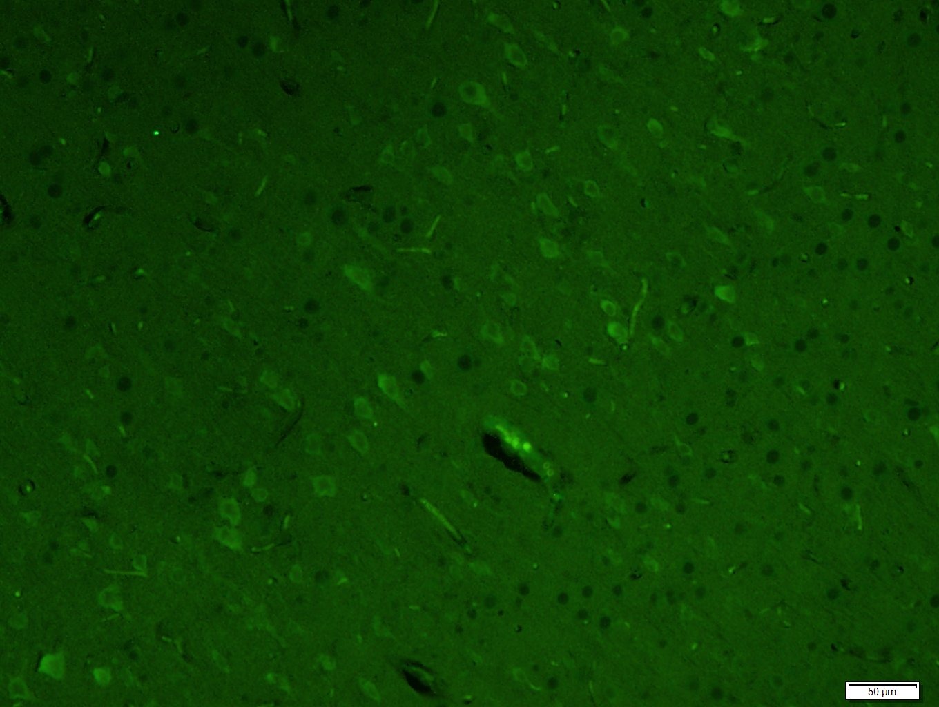 Anti-LC3A Antibody (4U976)
