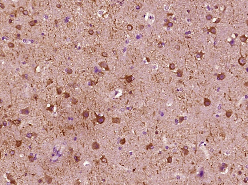 Anti-MAP2 Antibody (1T377)