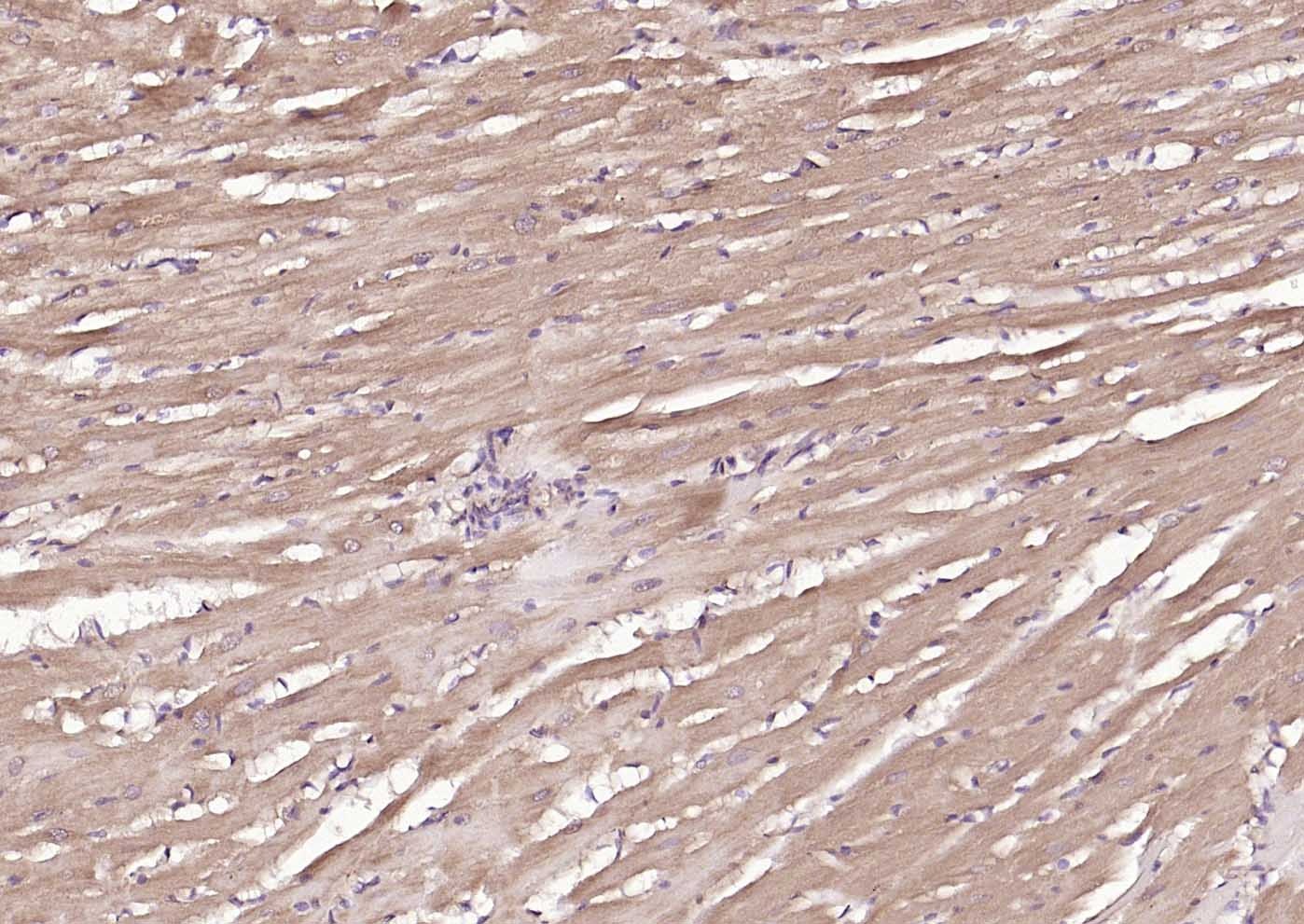 Anti-MFN1 Antibody (5U87)