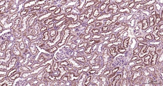 Anti-LAMP2 Polyclonal Antibody