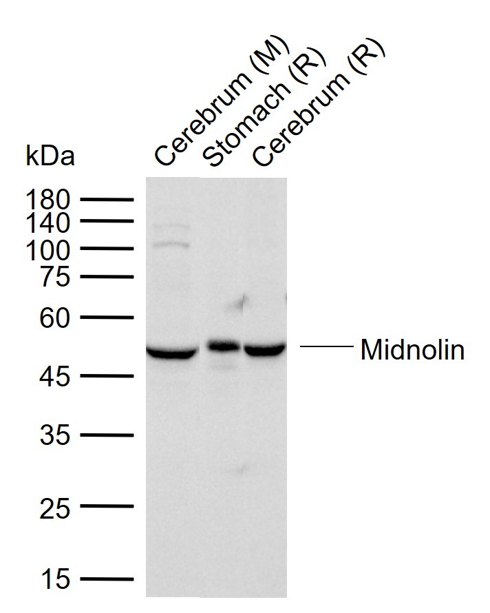 Anti-Midnolin Polyclonal Antibody
