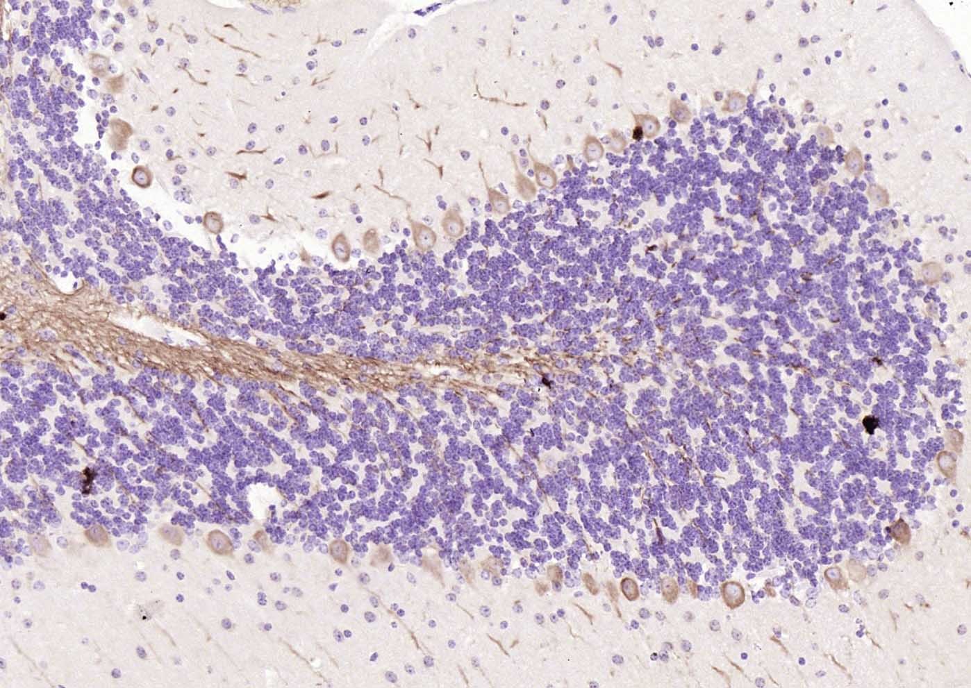 Anti-LC3A Antibody (4U976)