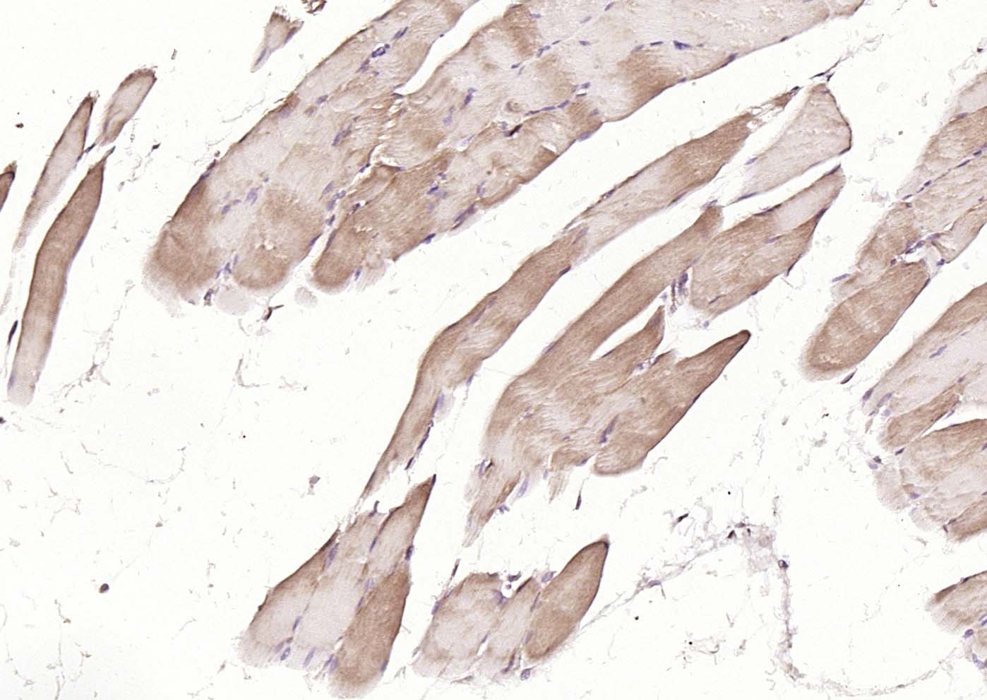 Anti-MFN1 Antibody (5U87)