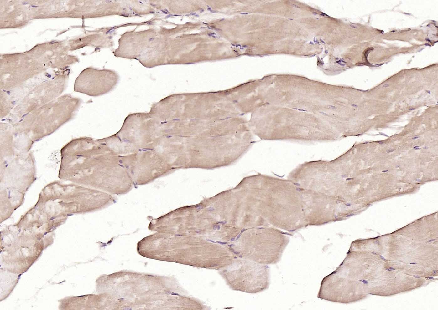 Anti-MFN1 Antibody (5U87)