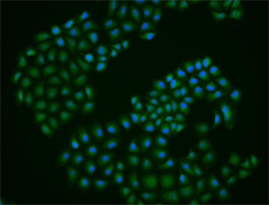 Anti-MITF Polyclonal Antibody