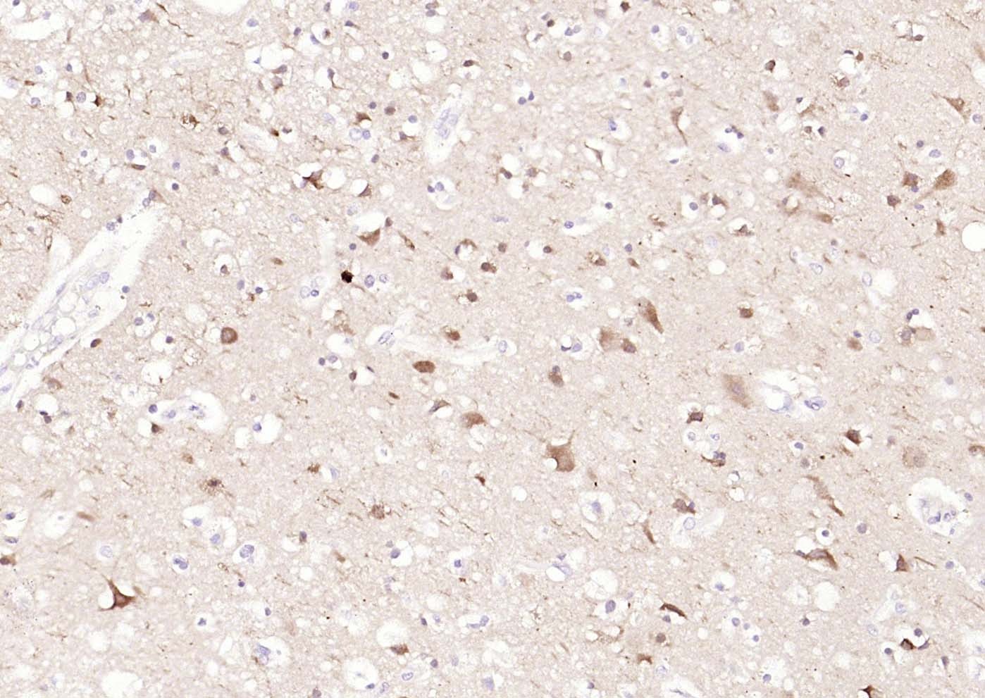 Anti-LC3A Antibody (4U976)