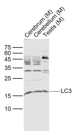 Anti-MAP1LC3A Polyclonal Antibody