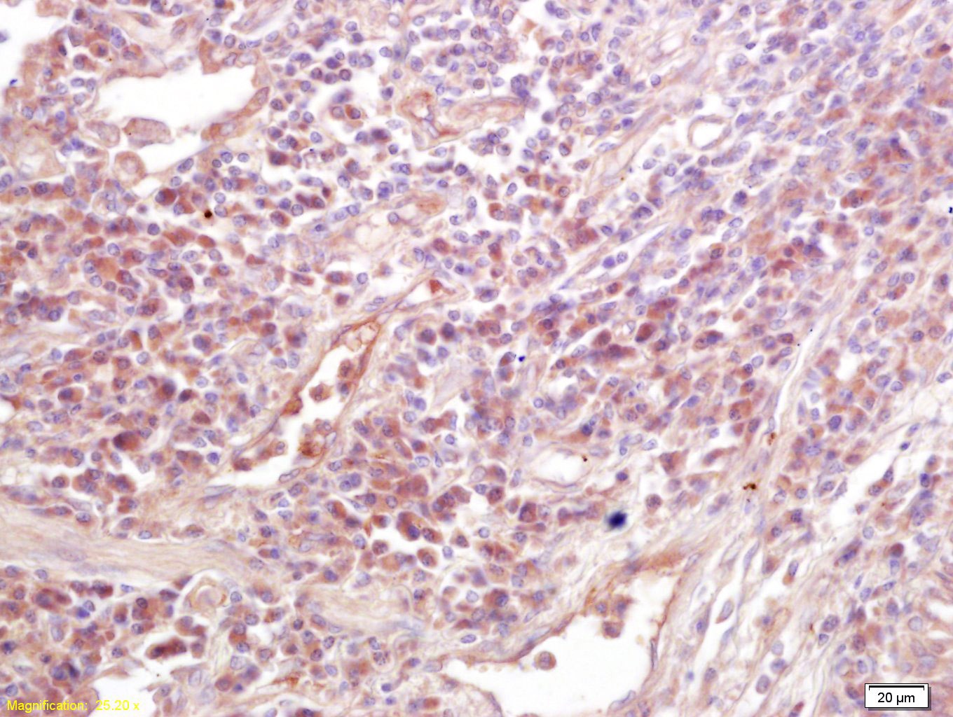 Anti-MICA Polyclonal Antibody