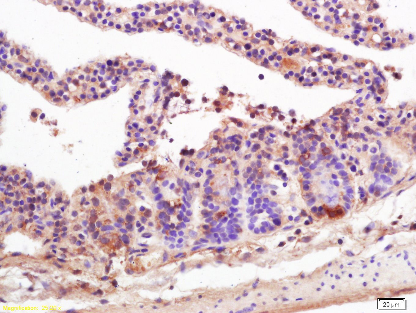 Anti-MICA Polyclonal Antibody
