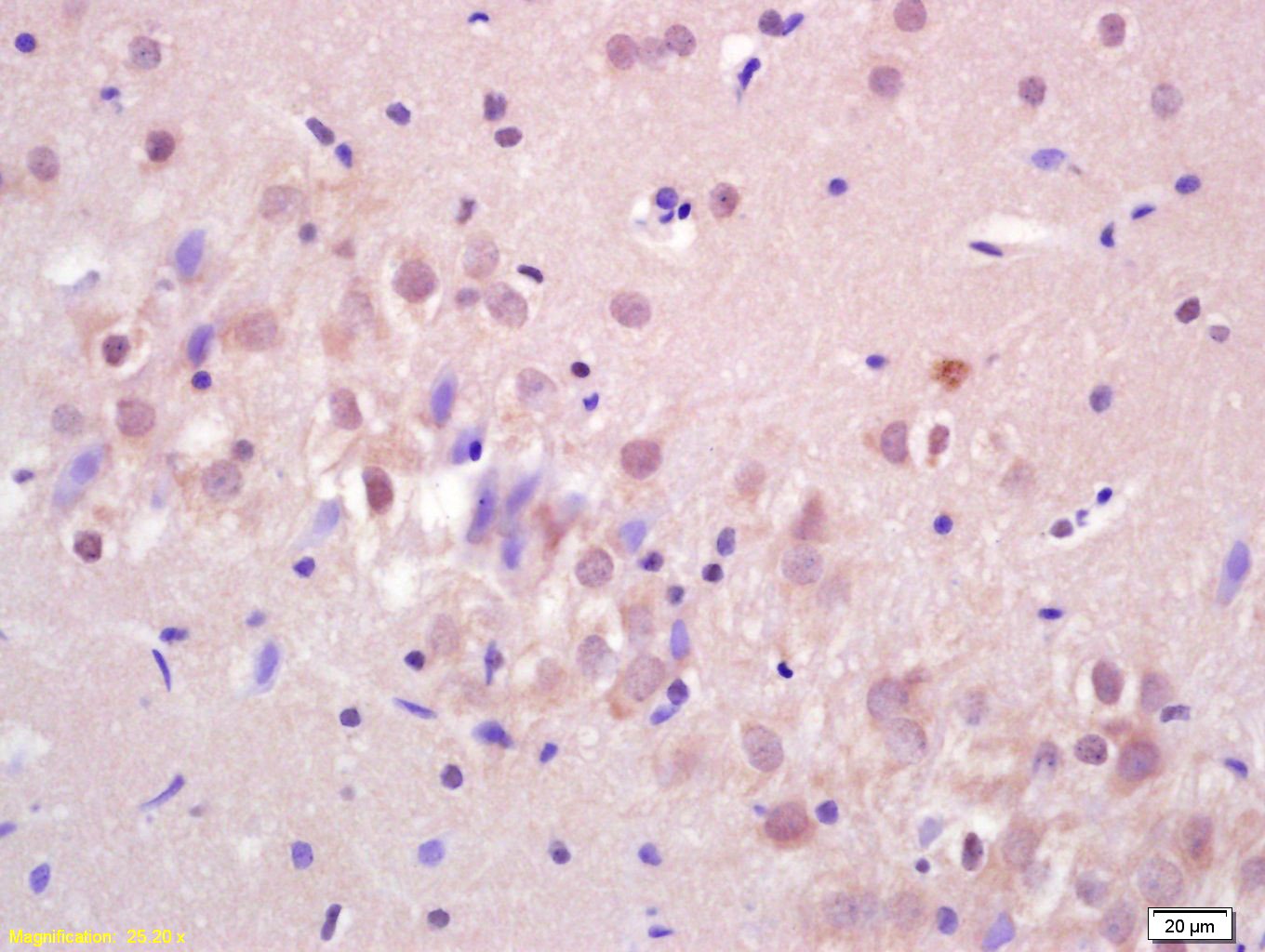 Anti-LIMK1 Polyclonal Antibody