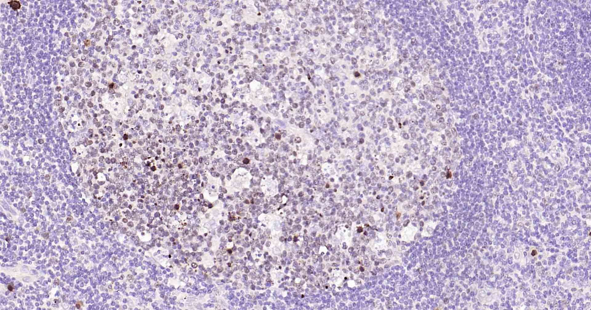 Anti-MKI67 Polyclonal Antibody