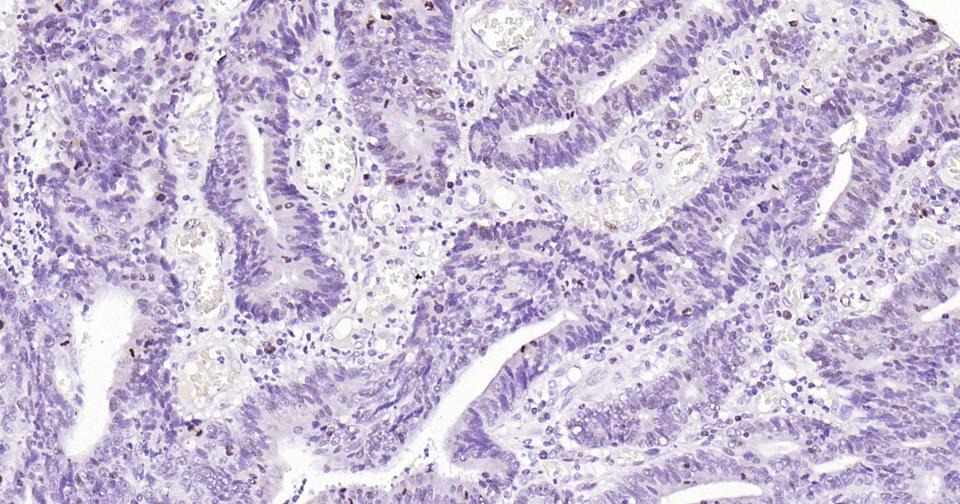 Anti-MKI67 Antibody (3H14)