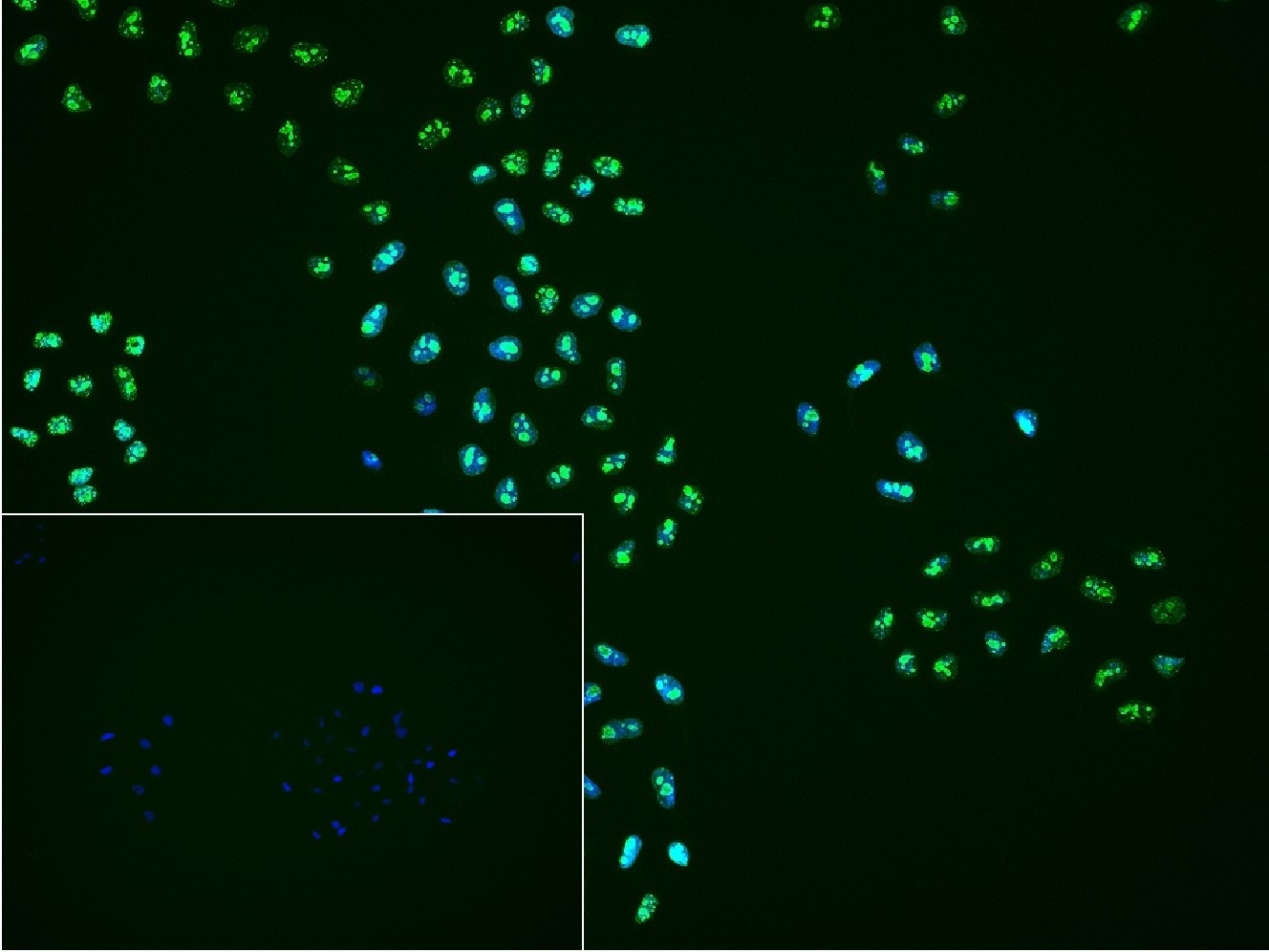 Anti-MKI67 Polyclonal Antibody