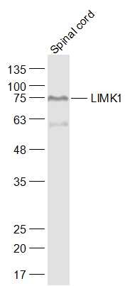 Anti-LIMK1 Polyclonal Antibody