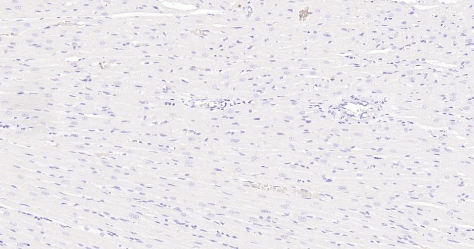 Anti-MKI67 Antibody (3H14)