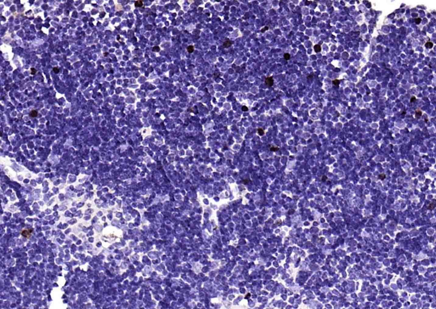 Anti-MKI67 Antibody (3H14)