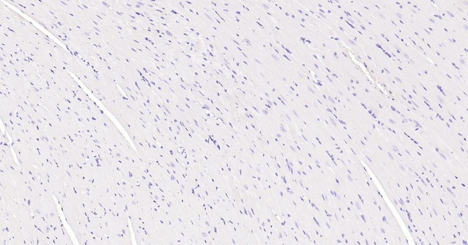 Anti-MKI67 Antibody (3H14)
