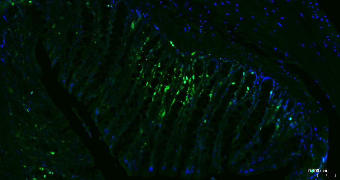 Anti-MKI67 Antibody (3H14)