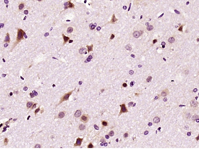 Anti-LIMK1 Polyclonal Antibody