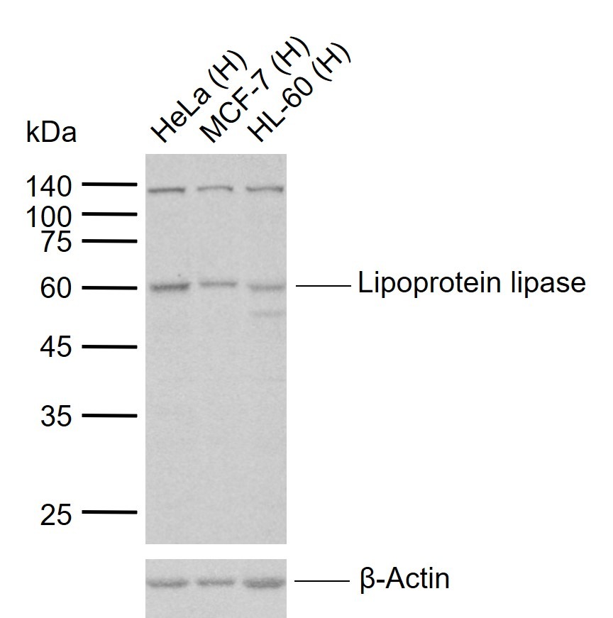 Anti-Lipoprotein lipase Polyclonal Antibody