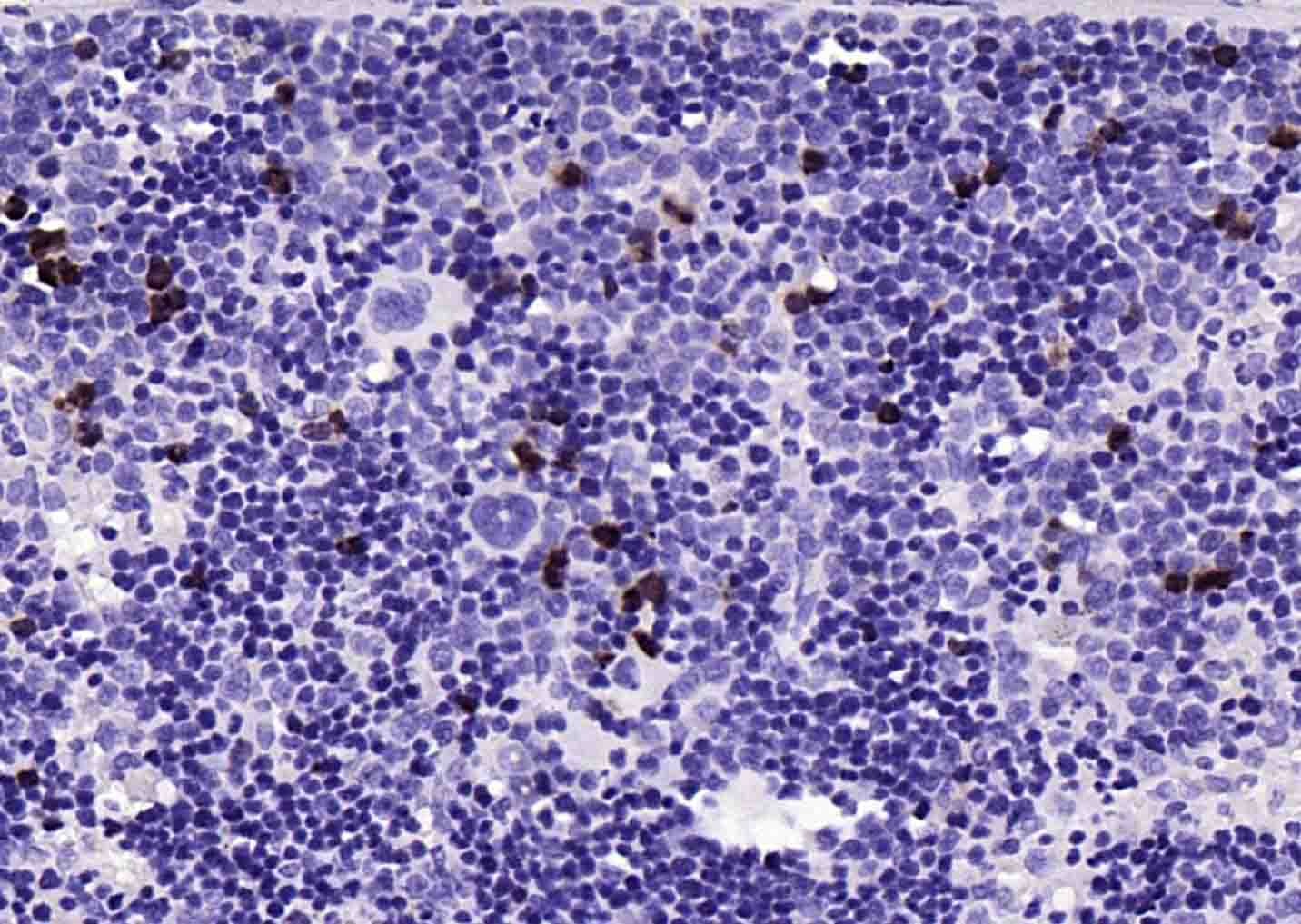 Anti-MKI67 Antibody (3H14)
