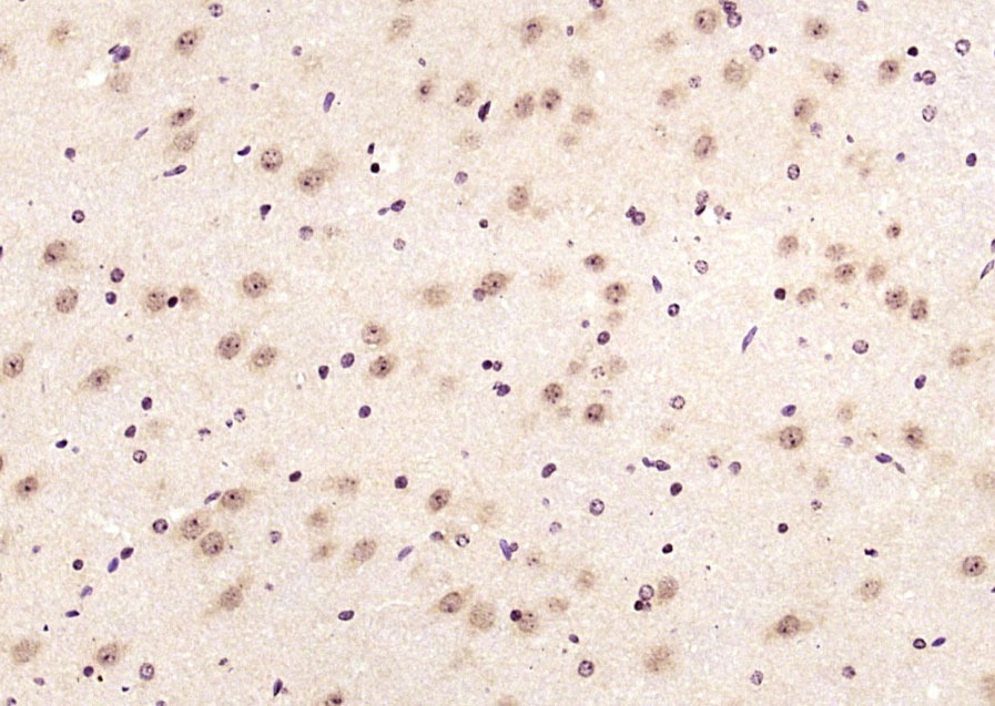 Anti-LIMK1 Polyclonal Antibody