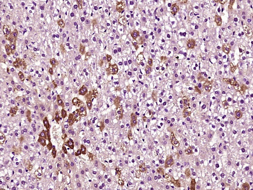 Anti-Lipoprotein lipase Polyclonal Antibody