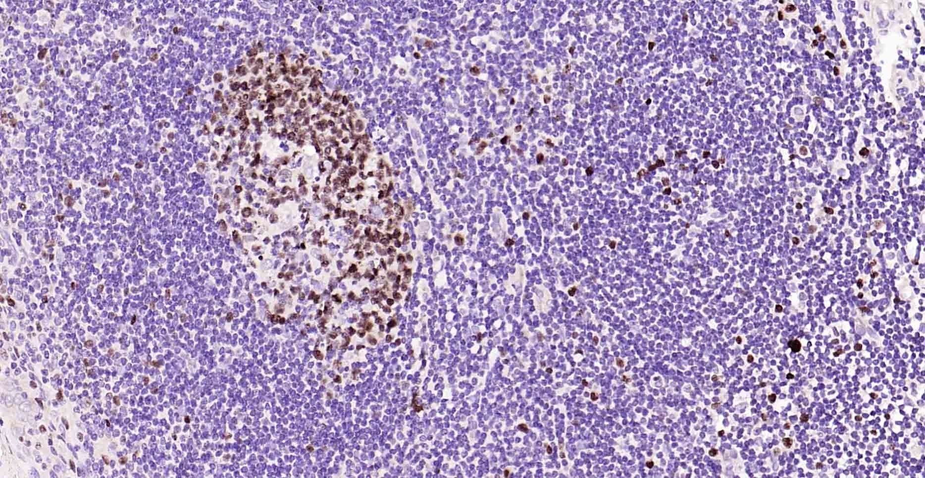 Anti-MKI67 Antibody (3A821)