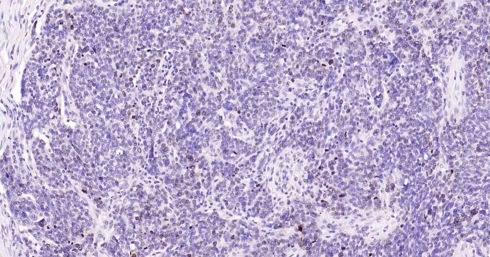 Anti-MKI67 Polyclonal Antibody