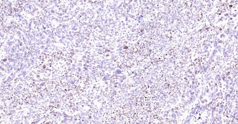 Anti-MKI67 Antibody (3H14)