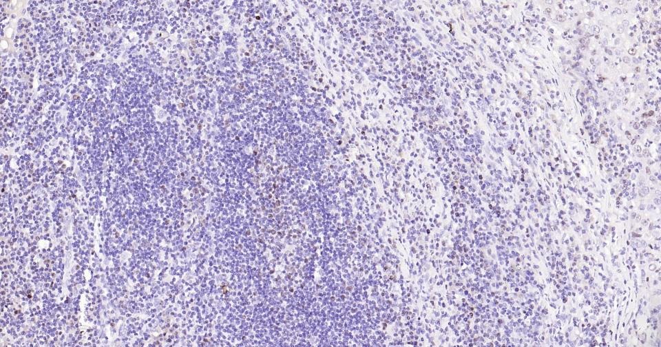 Anti-MKI67 Antibody (3H14)