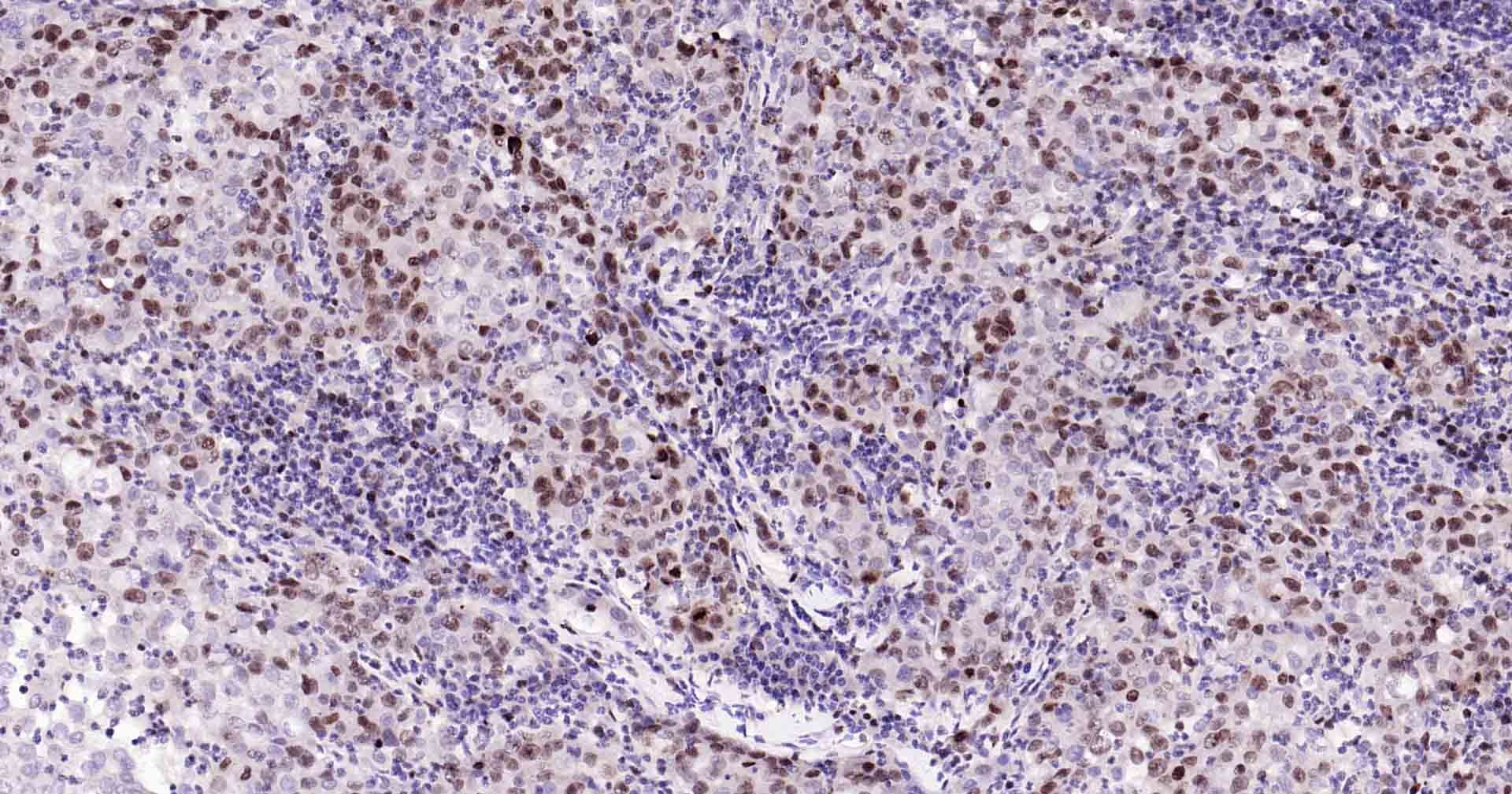 Anti-MKI67 Antibody (3A821)