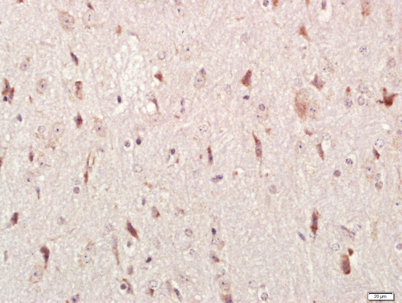 Anti-HEG1 Polyclonal Antibody