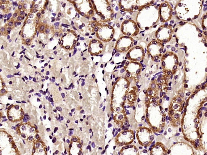 Anti-HDAC6 Polyclonal Antibody