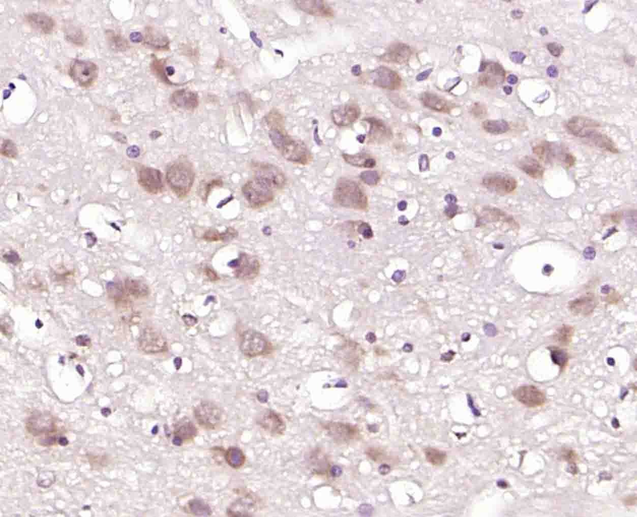 Anti-GRP75 Polyclonal Antibody