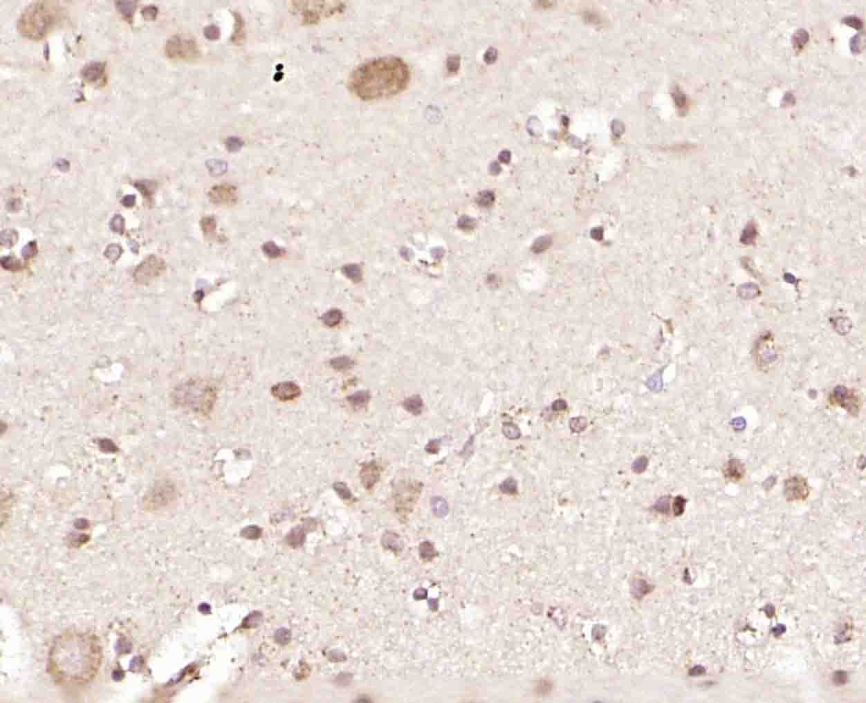 Anti-GRP75 Polyclonal Antibody